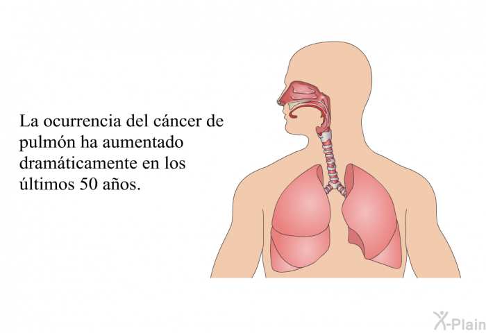 La ocurrencia del cncer de pulmn ha aumentado dramticamente en los ltimos 50 aos.