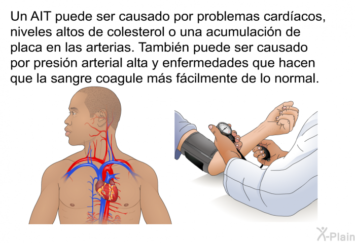 Un AIT puede ser causado por problemas cardacos, niveles altos de colesterol o una acumulacin de placa en las arterias. Tambin puede ser causado por presin arterial alta y enfermedades que hacen que la sangre coagule ms fcilmente de lo normal.