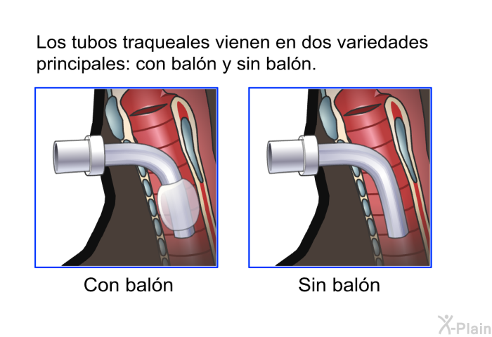 Los tubos traqueales vienen en dos variedades principales: con baln y sin baln.