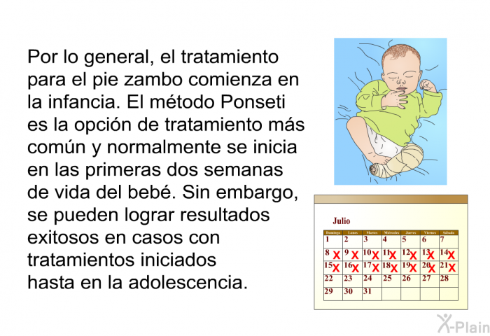 Por lo general, el tratamiento para el pie zambo comienza en la infancia. El mtodo Ponseti es la opcin de tratamiento ms comn y normalmente se inicia en las primeras dos semanas de vida del beb. Sin embargo, se pueden lograr resultados exitosos en casos con tratamientos iniciados hasta en la adolescencia.