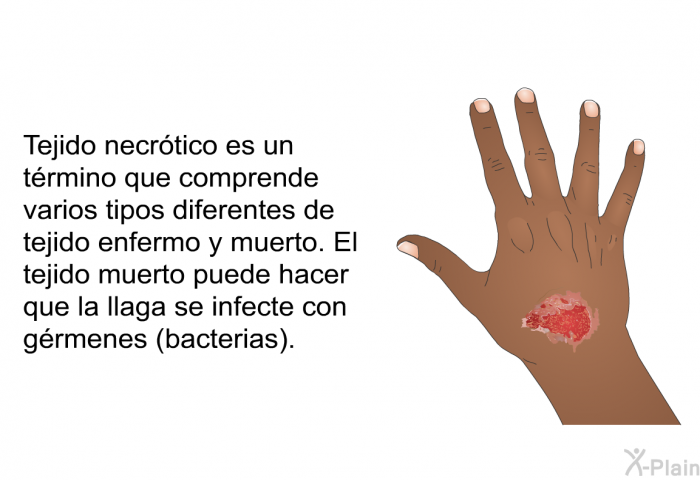 Tejido necrtico es un trmino que comprende varios tipos diferentes de tejido enfermo y muerto. El tejido muerto puede hacer que la llaga se infecte con grmenes (bacterias).