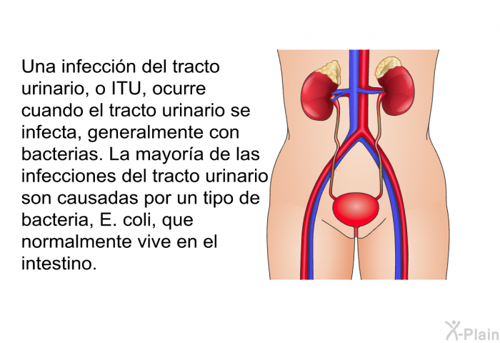 Una infeccin del tracto urinario, o ITU, ocurre cuando el tracto urinario se infecta, generalmente con bacterias. La mayora de las infecciones del tracto urinario son causadas por un tipo de bacteria, <I>E. coli</I>, que normalmente vive en el intestino.