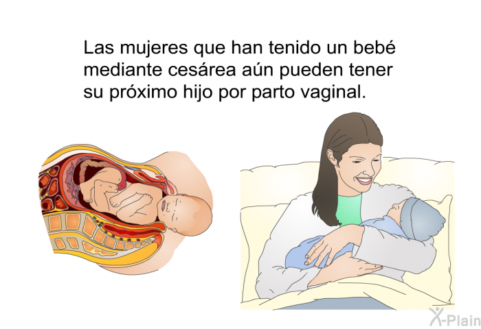 Las mujeres que han tenido un beb mediante cesrea an pueden tener su prximo hijo por parto vaginal.