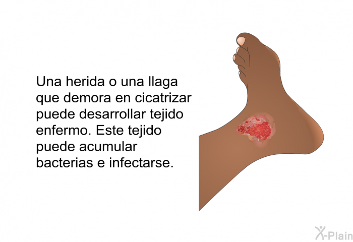 Una herida o una llaga que demora en cicatrizar puede desarrollar tejido enfermo. Este tejido puede acumular bacterias e infectarse.